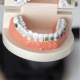 a model of teeth with braces